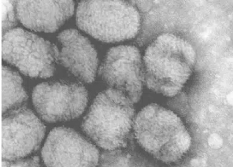 Làm sống lại virus từng tồn tại cách đây 30.000 năm 